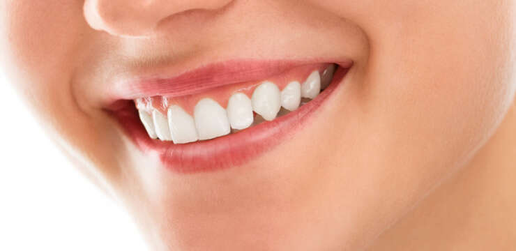 מהפך בשיניים ביום אחד 6 דברים שעליכם לקחת בחשבון